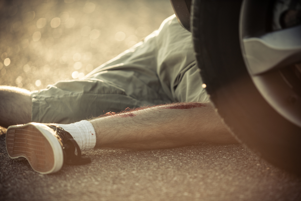 Photo of Hit-and-Run