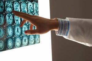 Tempe, AZ brain injury attorney