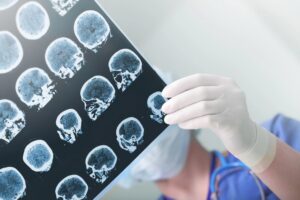 brain injury lawyer in Tempe, Arizona